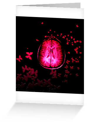 253940-10-butterfly-brain