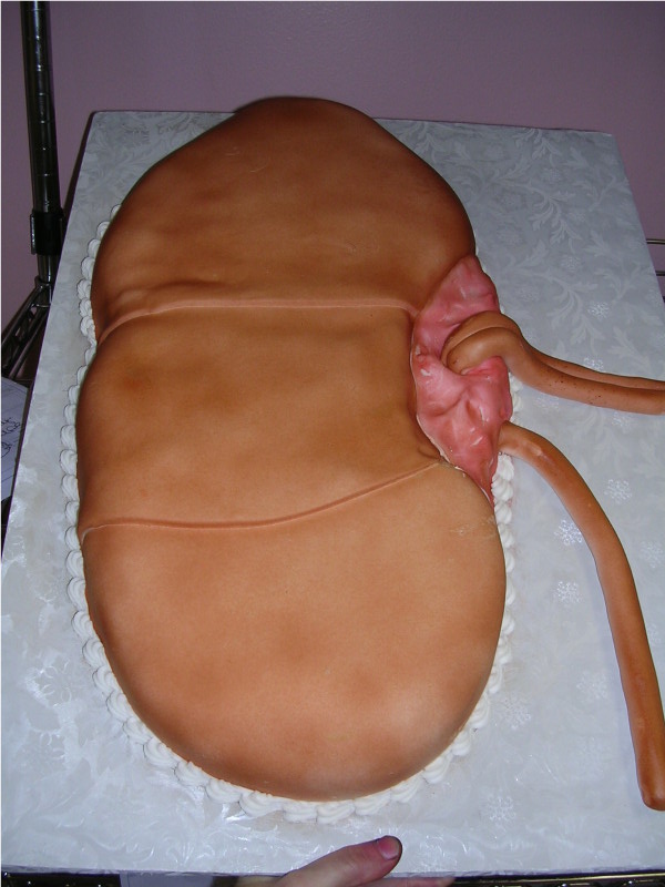 Organ Cakes – SheWalksSoftly