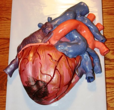 Monique R hrt attack