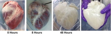 DecellularizationPorcineHeart